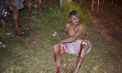 Homem-teve-o-joelho-cortado