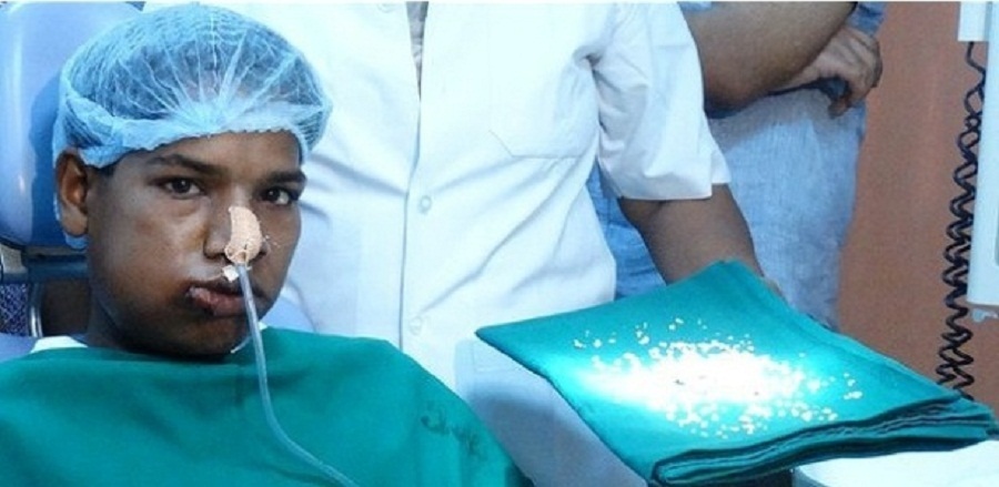 caso-de-ashik-gavai-foi-descrito-como-muito-raro-1406188117574_615x300