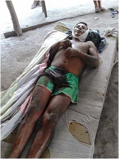 Renilson-Gomes-foi-assassinado-com-quatro-facadas