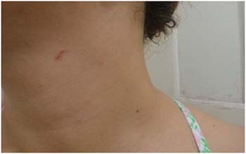 Advogada-mostra-marcas-em-seu-pescoço-da-agressão