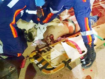 Rafael-Menezes-Gomes-de-29-anos-teve-seu-braço-arrancado-na-hora-da-batida