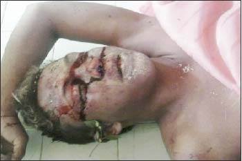 Emerson-dos-Santos-foi-assassinado-com-várias-pedradas-na-cabeça