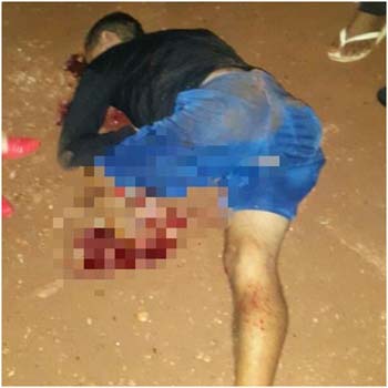 Vendedor-de-batata-frita-teve-perna-decepada