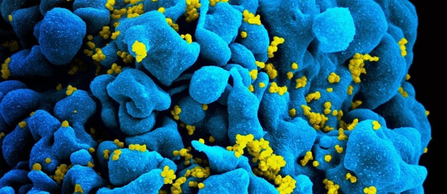 2015_813573977-hiv.jpg_20150504