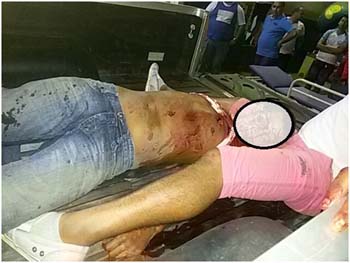 Cleuton Nascimento participava de uma festa e foi ferido mortalmente durante uma briga