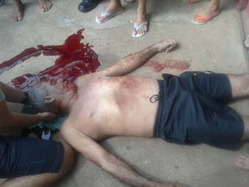 Raimundo-Galúcio-foi-ferido-na-cabeça