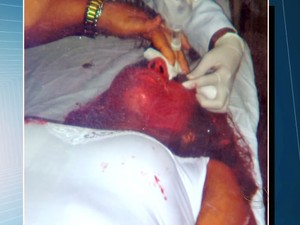 Formanda foi atingida por tinta na cabeça e não
colou grau em Cuiabá (Foto: Reprodução/TVCA)