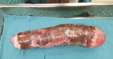 Divulgação internet (Foto)