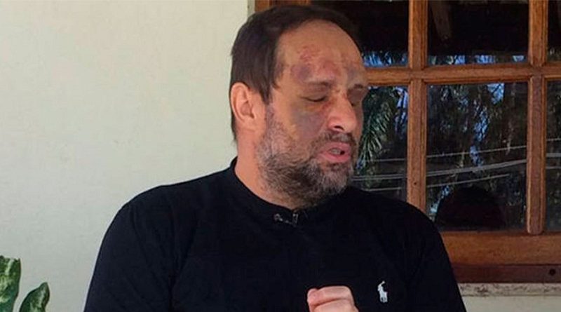 destaque-378525-rafa