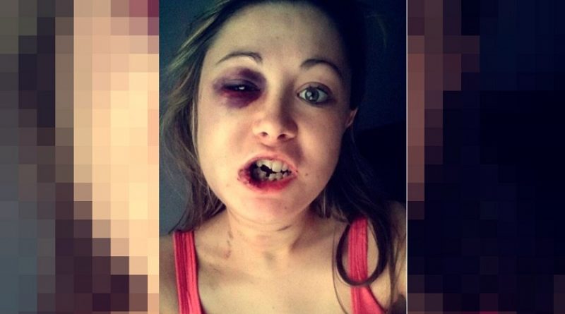 destaque-380823-agredida