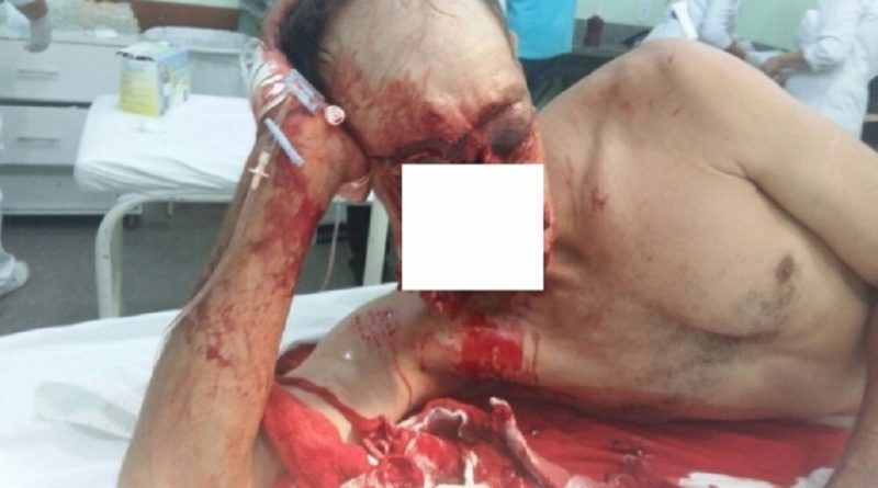 noticia_5824bb2f69925