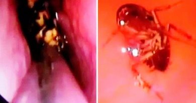 destaque-392694-barata-viva-cranio-retirada