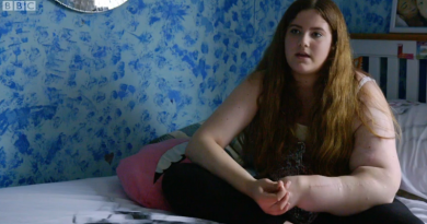 95287404brazoplanomedio