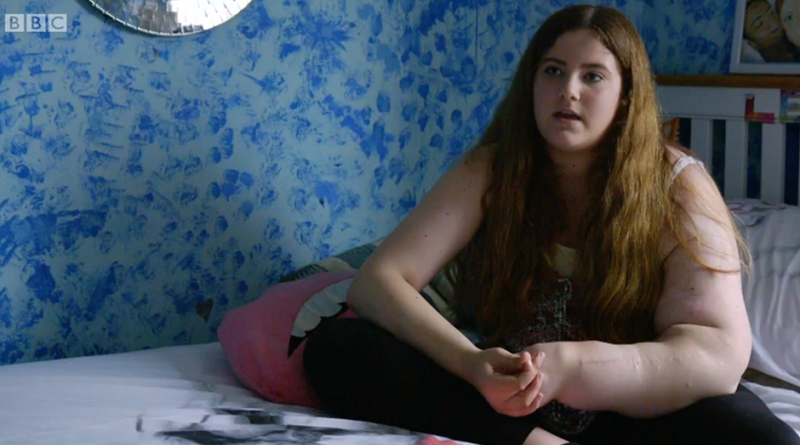 95287404brazoplanomedio