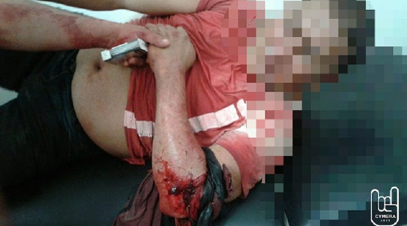 CYMERA_20170507_162835