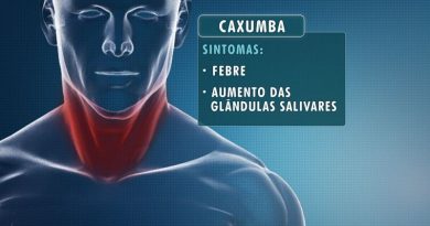 arte_caxumba_06_12_2016