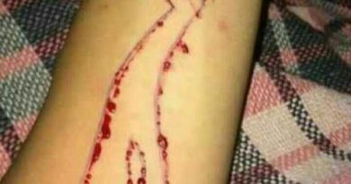 cad91cb0-1151-488f-8c28-a0767ec3b162