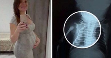 claudineia-dos-santos-melo-que-foi-baleada-e-uma-imagem-de-exame-do-bebe-1499359563277_615x300