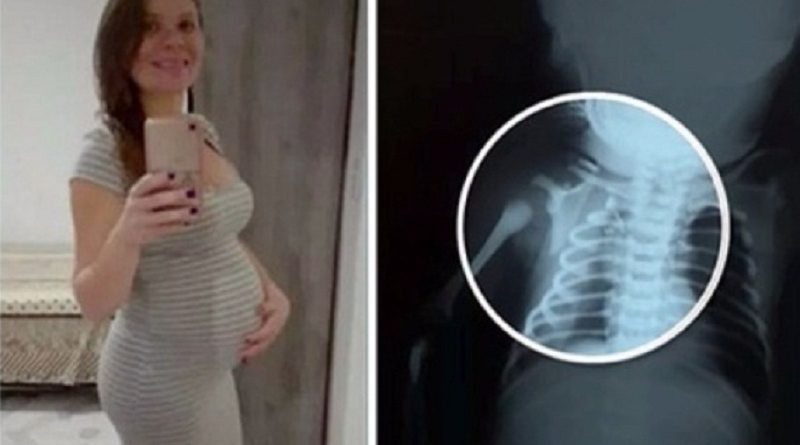 claudineia-dos-santos-melo-que-foi-baleada-e-uma-imagem-de-exame-do-bebe-1499359563277_615x300