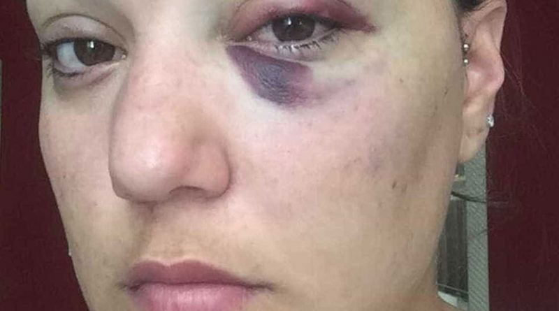 destaque-473129-naom_5a33bd3eda50d