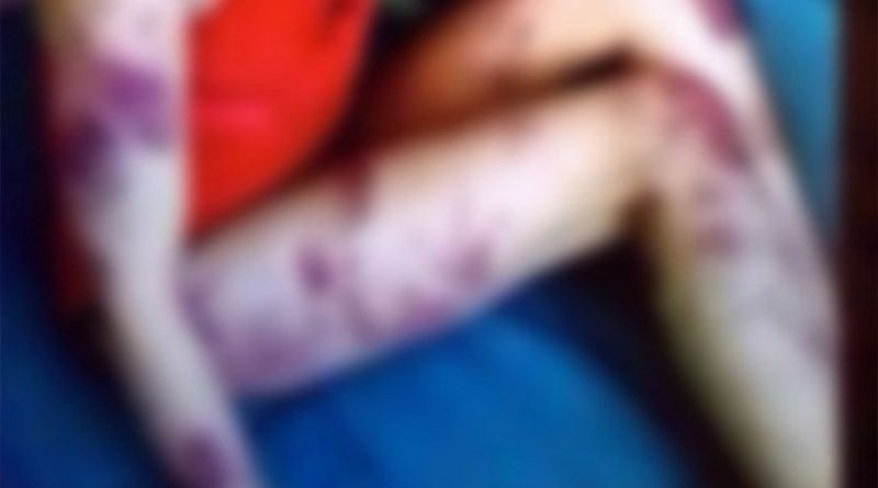 destaque-474851-t24t42t