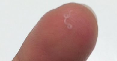 abby-beckley-descobriu-larva-dentro-do-olho-de-quase-meio-centimetro-viva-e-se-mexendo-1518614106953_615x300