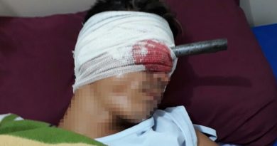 destaque-487235-olho