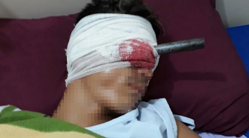 destaque-487235-olho