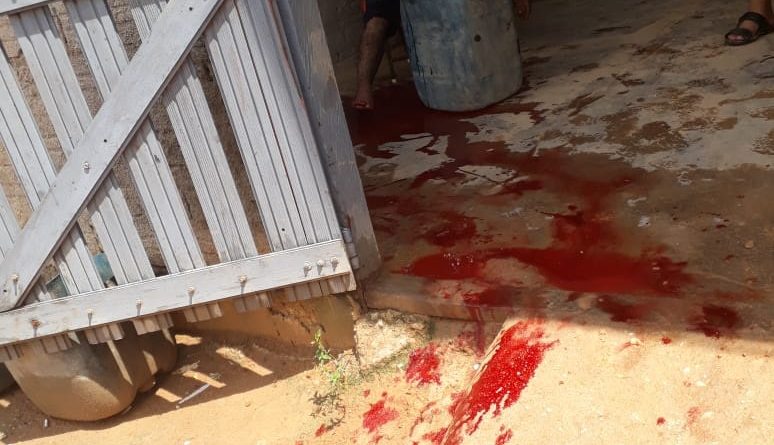 Jouglas Oliveira Carvalho acusado feriu o pé
(Foto:WhatsApp)