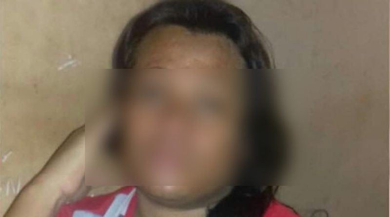 destaque-586425-homo