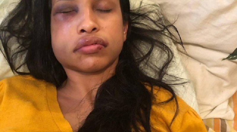 vitima espancada-jogador de futebol