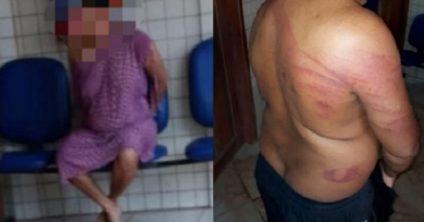 mulher agride o esposo