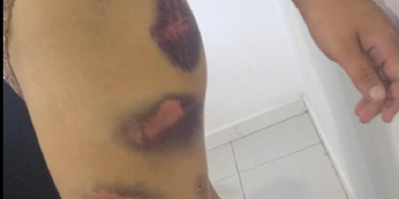 agressoes contra mulher