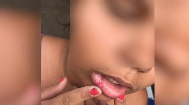 menina 10 anos espancada por mae