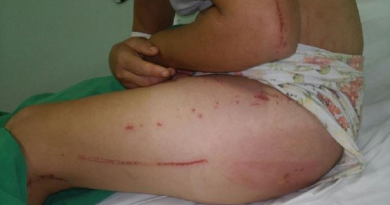 mulher roubada e estrupada