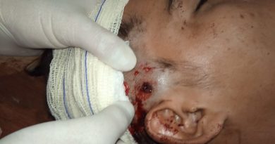 A perfuração atravessou a cabeça do jovem (Foto:Reprodução)