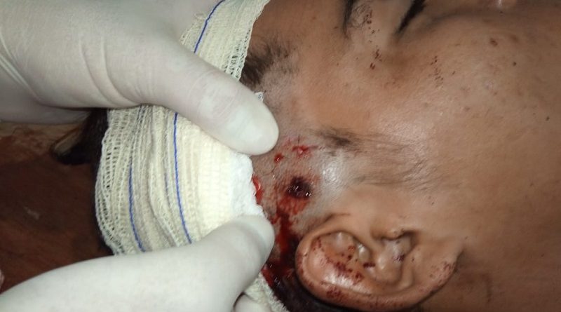 A perfuração atravessou a cabeça do jovem (Foto:Reprodução)