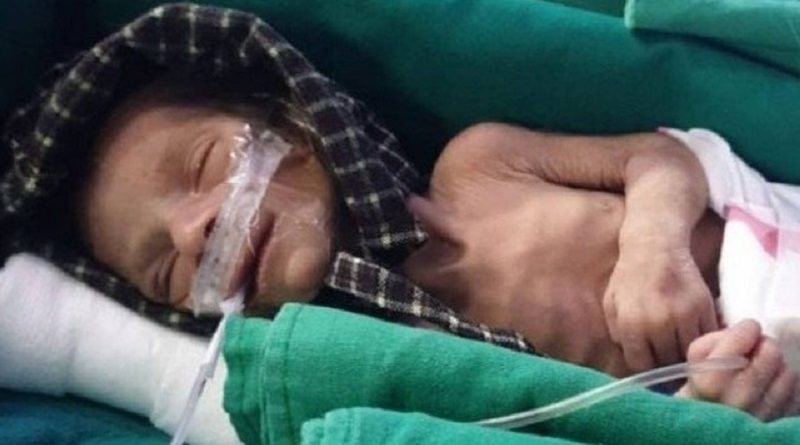 bebe-enterrada.jpg.pagespeed.ic_.Fce86nNbGx