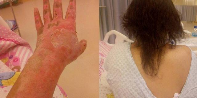 xjovemtevecorpoqueimado-jpg-pagespeed-ic-5iu6nb-2Nl