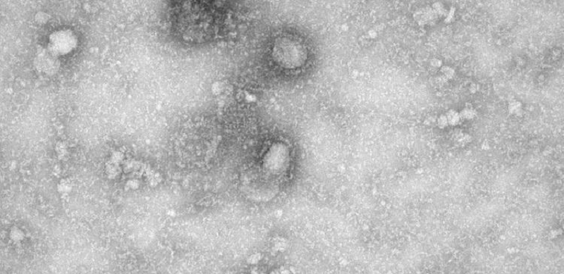 coronavirus1