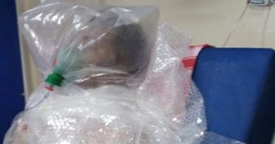 respirador plastico manaus