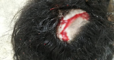 marido agride a esposa2