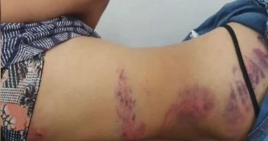 AGRESSOES_00600316_0_