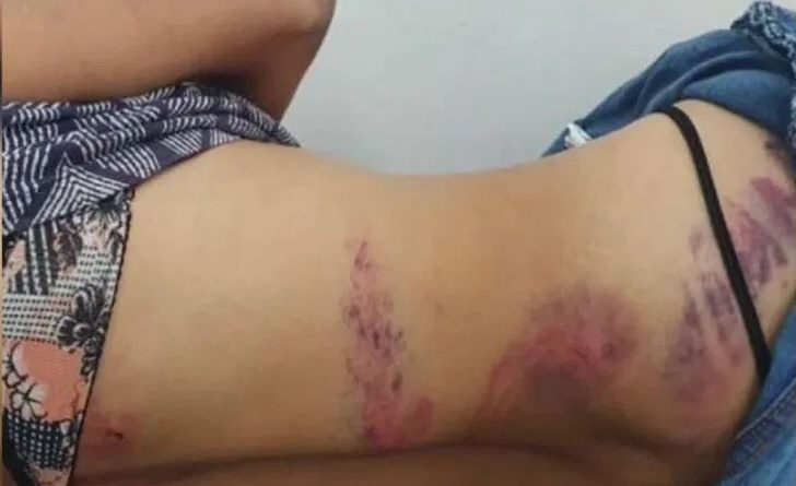 AGRESSOES_00600316_0_