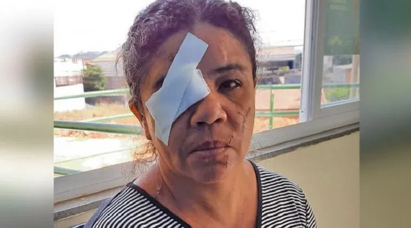 mulher esfaquiada no olho