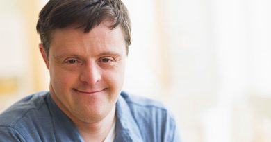 Síndrome-de-Down-Trissomia-21-a