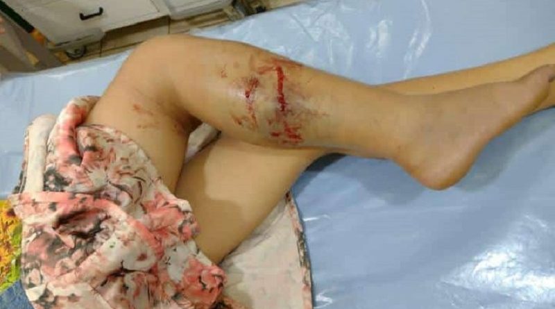 WhatsApp-Image-2021-11-18-at-13.34.17