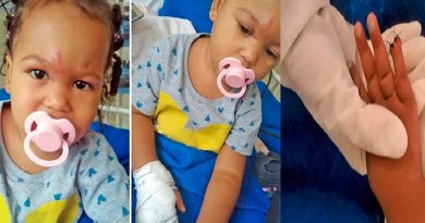 criança dedo cortado