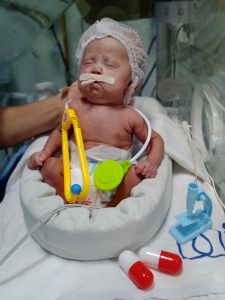 Bebes da UTI Neonatal participaram de ensaio fotografico em homenagem ao dia dos médicos. fotografia Ascom HRSP (1)