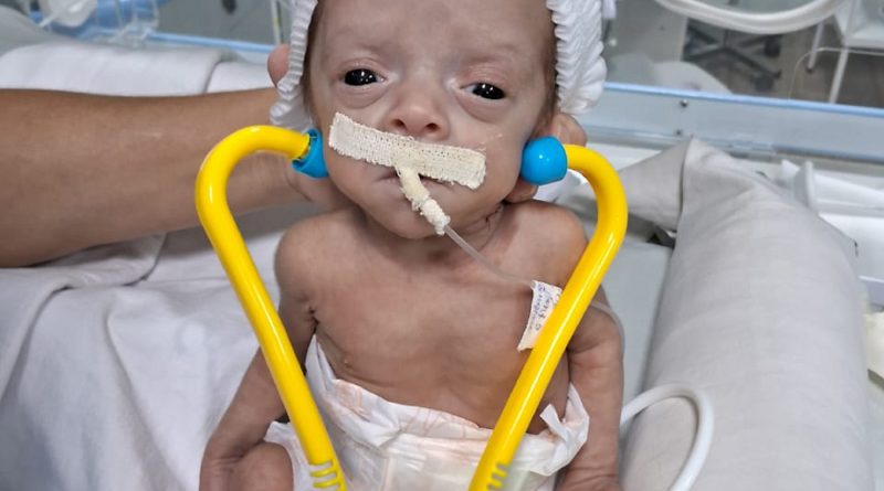 Bebes da UTI Neonatal participaram de ensaio fotografico em homenagem ao dia dos médicos. fotografia Ascom HRSP (2)